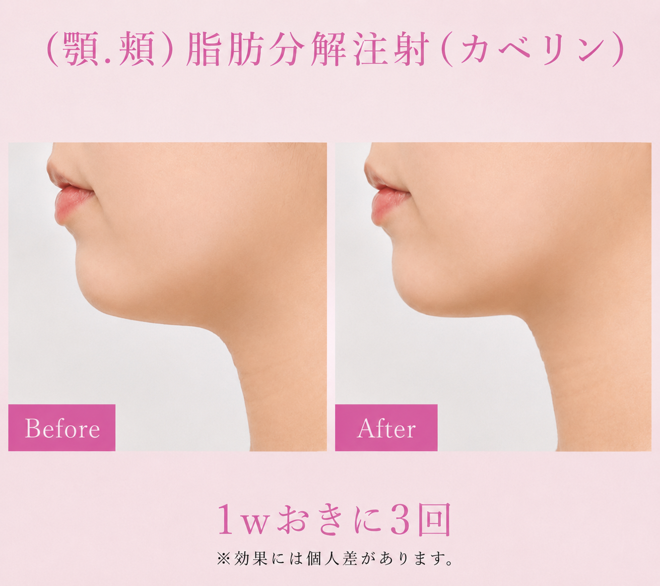 お顔の症例写真